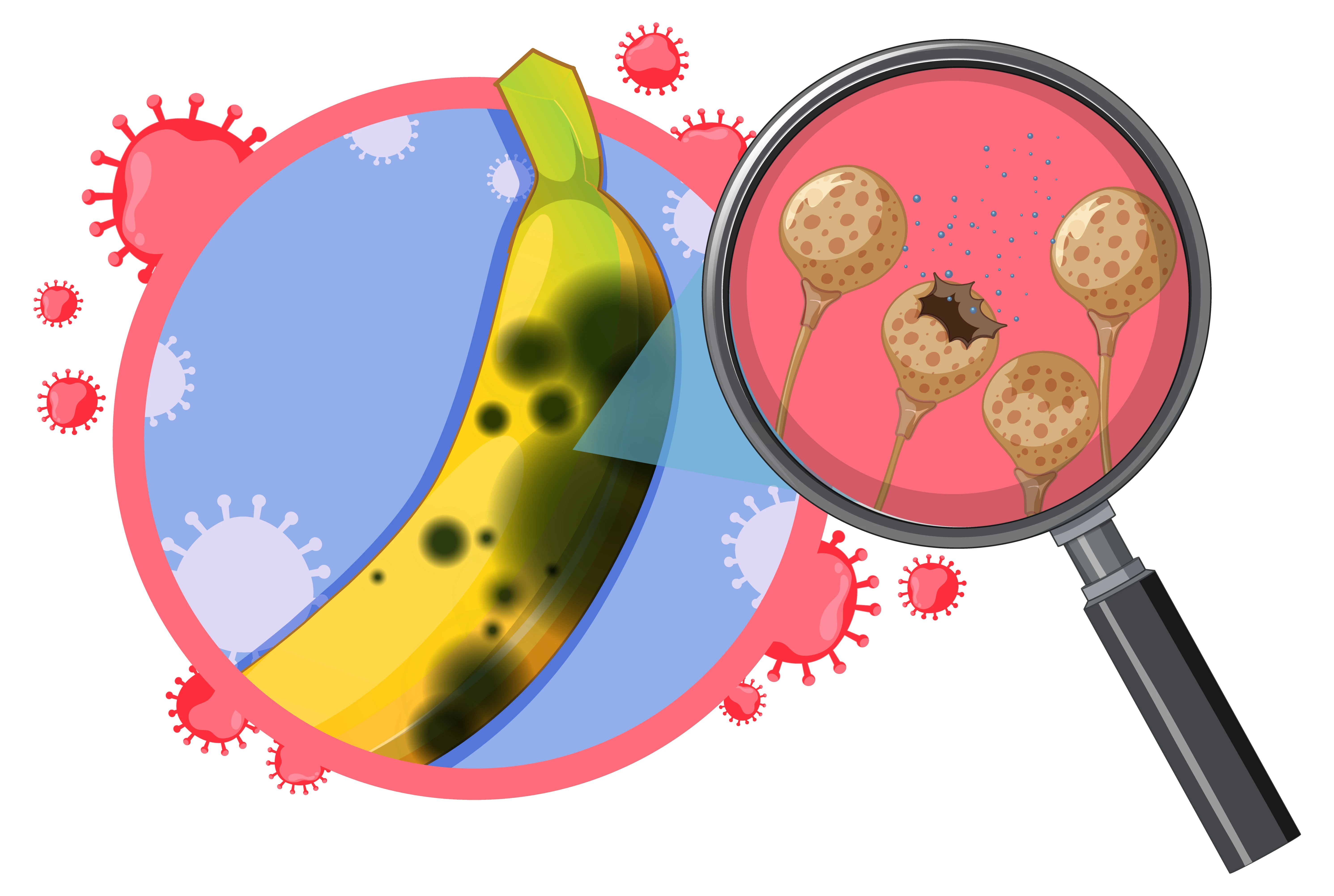 Bacterial fungal and Protozoal infections